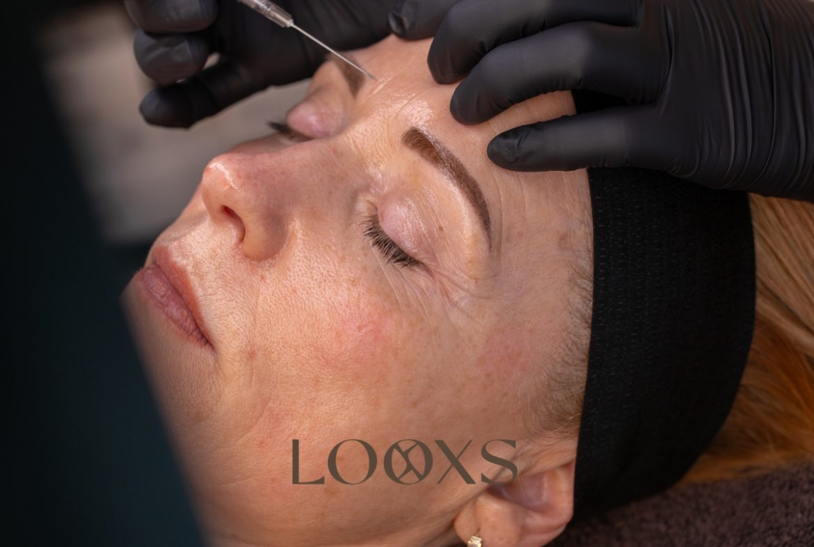 Botox en fillers behandeling bij Looxs The Skin Studio in Echt, Limburg